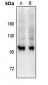Anti-GEF H1 (pS885) Antibody