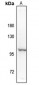 Anti-NF-kappaB p100 (pS869) Antibody