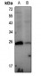 Anti-HSP27 (pS78) Antibody