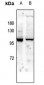Anti-GLUR1 (pS863) Antibody