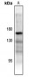 Anti-ASK1 (pT838) Antibody
