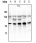 Anti-Glucocorticoid Receptor (pS203) Antibody
