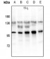 Anti-Glucocorticoid Receptor (pS203) Antibody