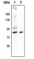 Anti-HSF1 (pS121) Antibody