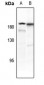 Anti-PDGFR beta (pY771) Antibody