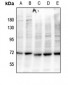 Anti-BLNK (pY84) Antibody