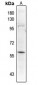 Anti-PALF (pS116) Antibody