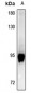 Anti-GAB2 (pY643) Antibody