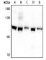 Anti-Kv2.1 (pS805) Antibody