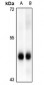 Anti-MK2 (pS272) Antibody