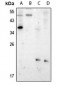 Anti-Presenilin 1 (pS357) Antibody