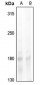 Anti-NCOA1 (pT1179) Antibody
