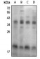 Anti-FHIT (pY114) Antibody