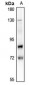 Anti-Lamin A/C (pS22) Antibody