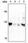 Anti-Focal Adhesion Kinase (pS722) Antibody