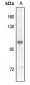 Anti-GABBR2 (pS893) Antibody