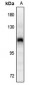 Anti-CD29 (pY795) Antibody