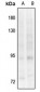 Anti-TRK B (pY817) Antibody