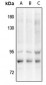 Anti-VAV3 (pY173) Antibody
