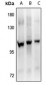 Anti-FGFR4 (pY642) Antibody