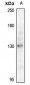 Anti-NEK9 Antibody