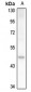 Anti-OCT6 Antibody