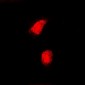 Anti-CAF-I p60 Antibody