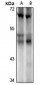 Anti-ILKAP Antibody