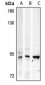 Anti-AMPD3 Antibody