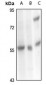 Anti-Carboxypeptidase M Antibody