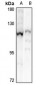 Anti-CHSY3 Antibody