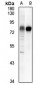 Anti-CD55 Antibody