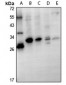 Anti-GSTT1 Antibody