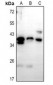 Anti-PTGR1 Antibody