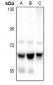 Anti-ME1 Antibody