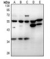 Anti-CD215 Antibody