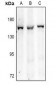 Anti-ITIH4 Antibody