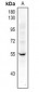 Anti-Factor XI HC Antibody