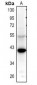 Anti-5-HT5A Antibody