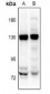 Anti-EMR1 Antibody