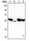Anti-CHRM4 Antibody