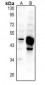 Anti-GPR150 Antibody