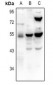 Anti-TRHR Antibody