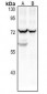 Anti-CD125 Antibody