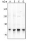 Anti-NCOA3 Antibody