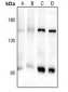 Anti-CD103 Antibody