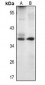 Anti-Livin Antibody