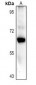 Anti-CARM1 Antibody