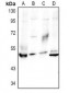 Anti-Granulin Antibody