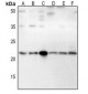 Anti-IFN beta Antibody